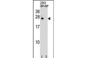 BCL2 Antibody (Center) (ABIN1881108 and ABIN2838804) pre-incubated without(lane 1) and with(lane 2) blocking peptide in 293 cell line lysate. (Bcl-2 anticorps  (AA 87-116))