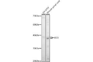 Western blot analysis of extracts of various cell lines, using DCX antibody (ABIN7266839) at 1:1000 dilution. (Doublecortin anticorps  (AA 240-360))