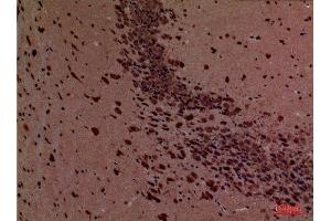 Immunohistochemistry (IHC) analysis of paraffin-embedded Mouse Brain, antibody was diluted at 1:100. (ROCK2 anticorps  (Internal Region))