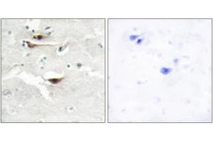 Immunohistochemistry analysis of paraffin-embedded human brain tissue, using IPPK Antibody. (IPPK anticorps  (AA 11-60))