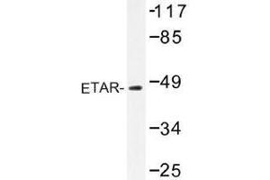 Image no. 1 for anti-Endothelin Receptor Type A (EDNRA) antibody (ABIN317861) (Endothelin-1 Receptor anticorps)
