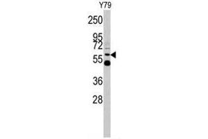 Western blot analysis of UDB17 antibody (Center) in Y79 cell line lysates (35ug/lane). (UGT2B17 anticorps  (Middle Region))