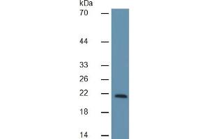 Western Blotting (WB) image for Retinol Binding Protein 4, Plasma (RBP4) ELISA Kit (ABIN6574239)