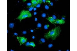 Immunofluorescence (IF) image for anti-ADP-Ribosylation Factor GTPase Activating Protein 1 (ARFGAP1) antibody (ABIN1496684) (ARFGAP1 anticorps)