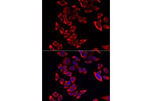 Immunofluorescence analysis of MCF-7 cell using RPL9 antibody. (RPL9 anticorps)