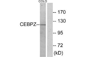 Western blot analysis of extracts from COLO cells, using C/EBP zeta antibody. (DDIT3 anticorps  (N-Term))