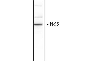 Western blot analysis of the HCV NS5B expression in Huh7 cells (Hepatitis C Virus anticorps)