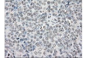 Immunohistochemical staining of paraffin-embedded colon tissue using anti-PPP5Cmouse monoclonal antibody. (PP5 anticorps)