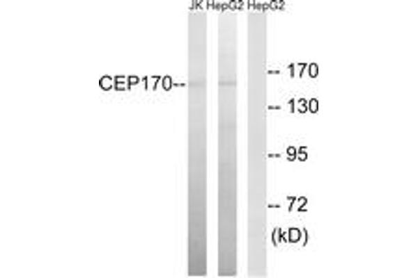 CEP170 anticorps  (AA 701-750)