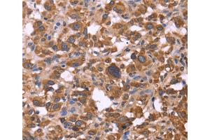 Immunohistochemistry (IHC) image for anti-F-Box and WD Repeat Domain Containing 7 (FBXW7) antibody (ABIN2429749) (FBXW7 anticorps)