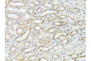 Immunohistochemistry of paraffin-embedded mouse kidney using MTOR antibody. (MTOR anticorps)
