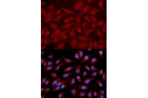 Immunofluorescence analysis of U2OS cells using RAPGEF3 antibody. (RAPGEF3 anticorps)