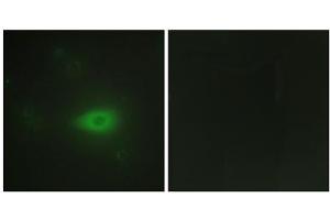 Immunofluorescence analysis of HepG2 ells, using HARS antibody. (HARS1/Jo-1 anticorps  (C-Term))