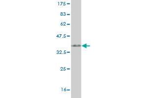 Western Blot detection against Immunogen (35. (SYN1 anticorps  (AA 362-450))