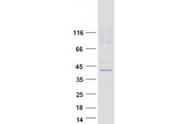 SLC29A1 Protein (Transcript Variant 1) (Myc-DYKDDDDK Tag)