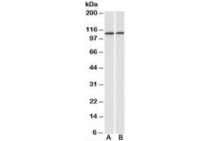 Western blot testing of human heart [A] and kidney [B] lysates with BMP antibody at 1ug/ml. (BMP anticorps)