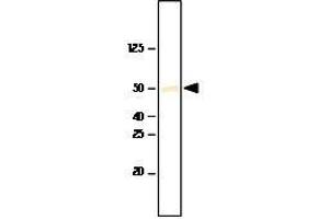 Recombinant SET7/9 was resolved by electrophoresis, transferred to PVDF membrane and probed with anti-SET7/9(1:1,000). (SET7/9 anticorps  (AA 1-366))