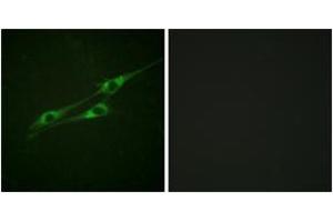 Immunofluorescence analysis of NIH-3T3 cells, using IL-13R/CD213 alpha1 (Ab-405) Antibody. (CD213alpha1 (AA 371-420) anticorps)