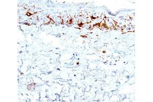 IHC testing of human skin stained with CD1a antibody (C1A/711). (CD1a anticorps)