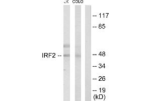 Immunohistochemistry analysis of paraffin-embedded human colon carcinoma tissue using IRF2 antibody. (IRF2 anticorps  (Internal Region))