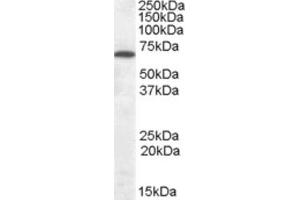 Western Blotting (WB) image for anti-Cannabinoid Receptor 1 (CNR1) (Internal Region) antibody (ABIN2465491) (CNR1 anticorps  (Internal Region))