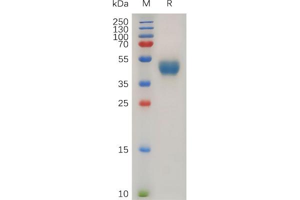 CXCR7 Protein (AA 1-40) (Fc Tag)