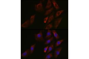 Immunofluorescence analysis of NIH/3T3 cells using SIRT3 Rabbit pAb (ABIN6134063, ABIN6147792, ABIN6147795 and ABIN6223143) at dilution of 1:50 (40x lens). (SIRT3 anticorps  (C-Term))