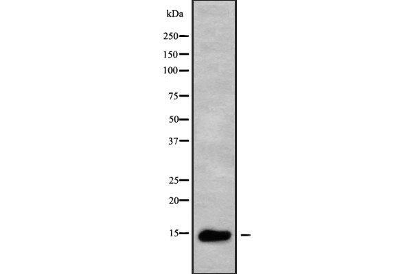 ZNRD1 anticorps  (Internal Region)