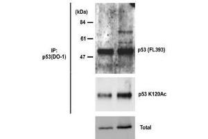 Western Blotting (WB) image for anti-Tumor Protein P53 (TP53) antibody (ABIN1449254) (p53 anticorps)