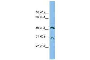 Image no. 1 for anti-Adenosine Deaminase (ADA) (AA 71-120) antibody (ABIN6744916) (ADA anticorps  (AA 71-120))