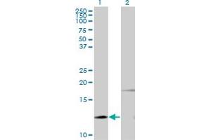 Western Blot analysis of PTH expression in transfected 293T cell line by PTH monoclonal antibody (M11), clone 3G9. (PTH anticorps  (AA 32-115))