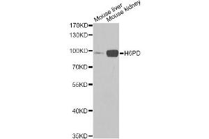 Western blot analysis of extracts of various cell lines, using H6PD Antibody (ABIN5973840) at 1/1000 dilution. (Glucose-6-Phosphate Dehydrogenase anticorps)