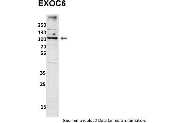 EXOC6 anticorps  (N-Term)