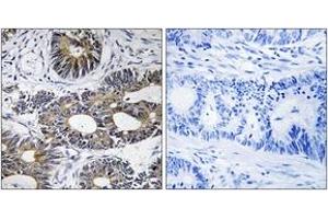 Immunohistochemistry (IHC) image for anti-Eukaryotic Translation Initiation Factor 1A, Y-Linked (EIF1AY) (AA 21-70) antibody (ABIN2890311) (EIF1AY anticorps  (AA 21-70))