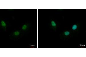 ICC/IF Image NTH1 antibody detects NTH1 protein at nucleus by immunofluorescent analysis. (Nth Endonuclease III-Like 1 (NTHL1) (Center) anticorps)