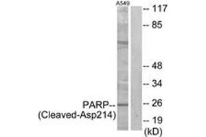 Western blot analysis of extracts from A549 cells, treated with etoposide 25uM 24h, using PARP (Cleaved-Asp214) Antibody. (PARP1 anticorps  (Cleaved-Asp214))