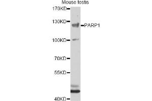 Western blot analysis of extracts of mouse testis, using PARP1 antibody (ABIN5995673) at 1/1000 dilution. (PARP1 anticorps)