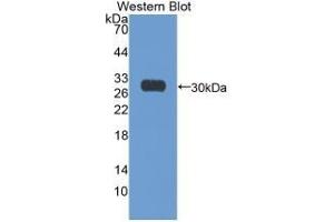 Detection of Recombinant Ki67P, Human using Monoclonal Antibody to Ki-67 Protein (Ki-67) (Ki-67 anticorps  (AA 3088-3235))
