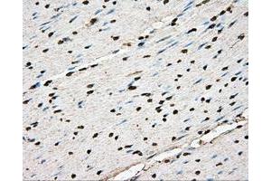 Immunohistochemical staining of paraffin-embedded liver tissue using anti-BSG mouse monoclonal antibody. (CD147 anticorps)