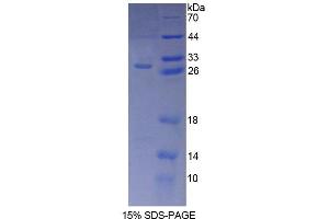 SDS-PAGE analysis of Human AIP Protein. (AIP Protéine)