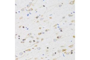 Immunohistochemistry of paraffin-embedded rat brain using CHRM5 antibody (ABIN5973103) at dilution of 1/100 (40x lens). (CHRM5 anticorps)