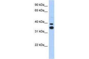 Image no. 1 for anti-Msh Momeobox 2 (Msx2) (N-Term) antibody (ABIN6742203) (Msx2/Hox8 anticorps  (N-Term))