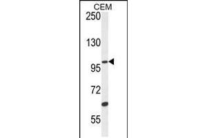 Western blot analysis in CEM cell line lysates (35ug/lane). (USP29 anticorps  (AA 660-690))