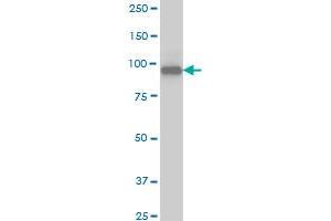 SRPK1 monoclonal antibody (M03), clone 6G9 Western Blot analysis of SRPK1 expression in Jurkat . (SRPK1 anticorps  (AA 371-470))