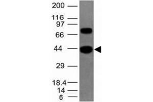 Western blot of human SKM tissue lysate using pan Muscle Actin antibody (Pan Muscle Actin anticorps)