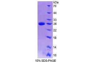 SDS-PAGE (SDS) image for Suppressor of Cytokine Signaling 2 (SOCS2) (AA 1-198) protein (His tag) (ABIN6237538) (SOCS2 Protein (AA 1-198) (His tag))