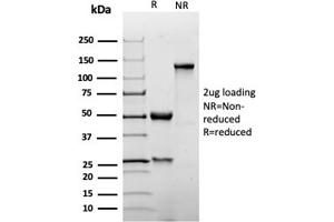 SDS-PAGE Analysis Purified p27 Recombinant Rabbit Monoclonal Antibody (KIP1/1355R). (Recombinant CDKN1B anticorps)
