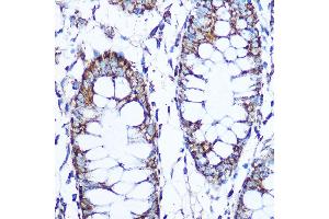 Immunohistochemistry of paraffin-embedded human tonsil using PLK1 Rabbit mAb (ABIN7269436) at dilution of 1:100 (40x lens). (PLK1 anticorps)