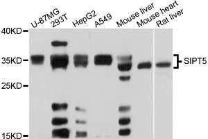 Western blot analysis of extracts of various cell lines, using SIRT5 antibody. (SIRT5 anticorps)