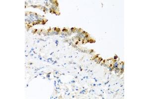 Immunohistochemistry of paraffin-embedded mouse lung using BMP4 antibody (ABIN5997308) at dilution of 1/100 (40x lens). (BMP4 anticorps)